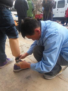 巍山县温情启动云南省2018年福康工程暨义肢助残项目 假肢助力，爱满古城